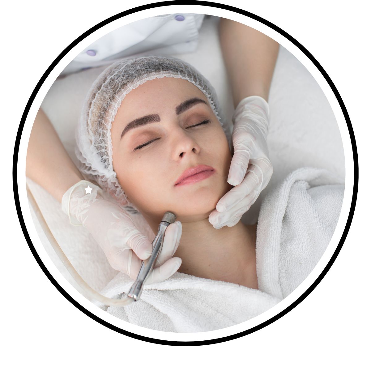 Microdermabrasion 